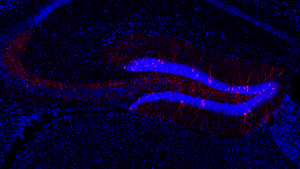 image of memory engram cells visualized in the brain